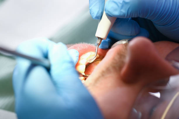 Best Cosmetic Emergency Dentistry in Arthurtown, SC