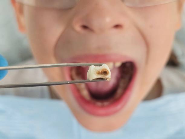 Best Emergency Denture Repair in Arthurtown, SC